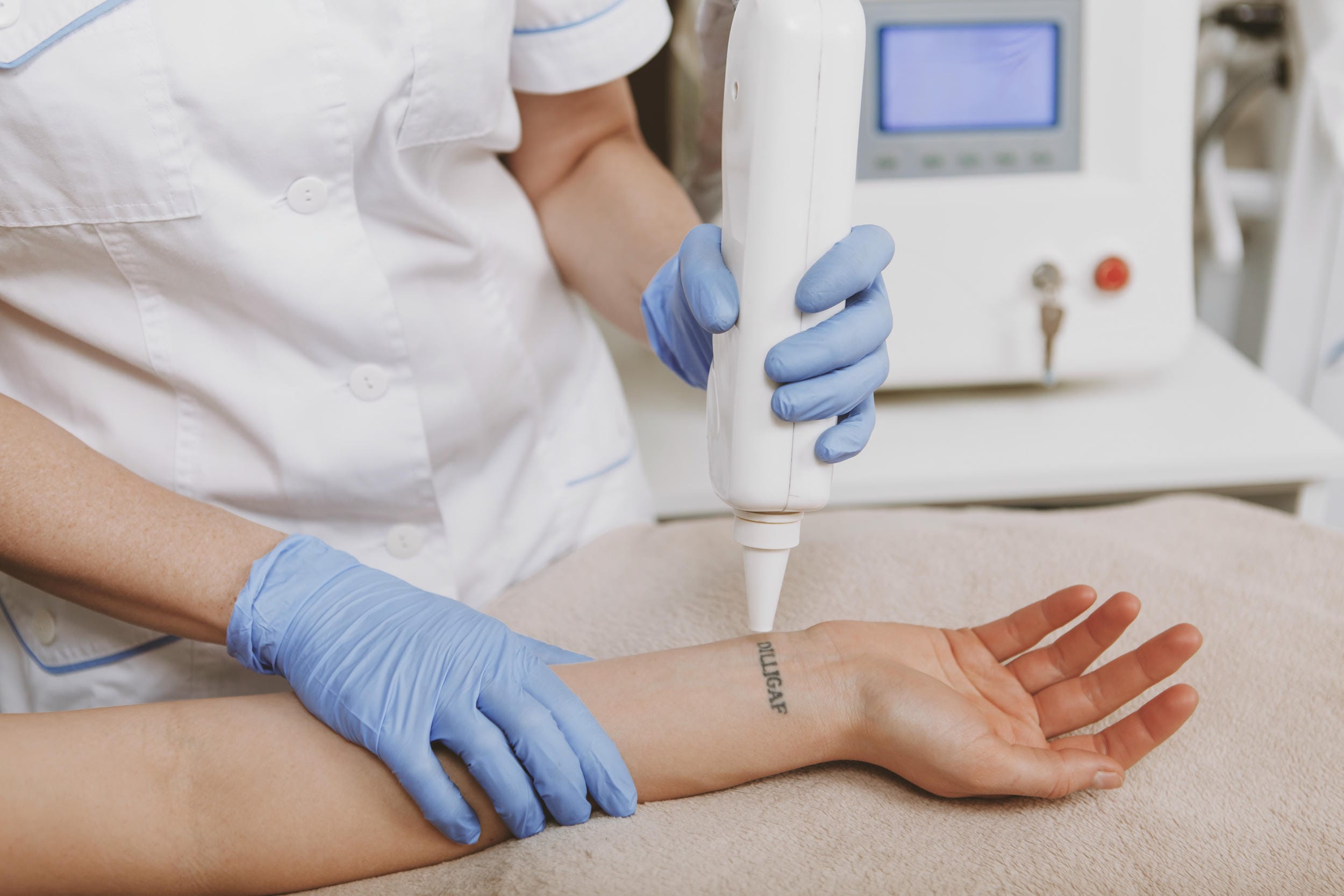 How TKTX Supports Laser Tattoo Removal Comfortably